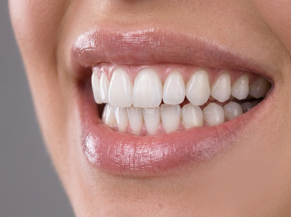 Smile after treatment